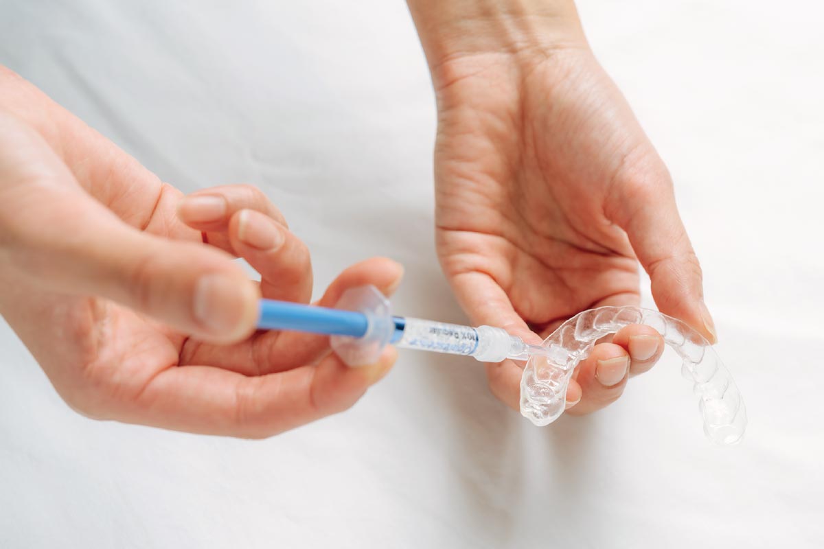 STEP2ホームホワイトニング実践