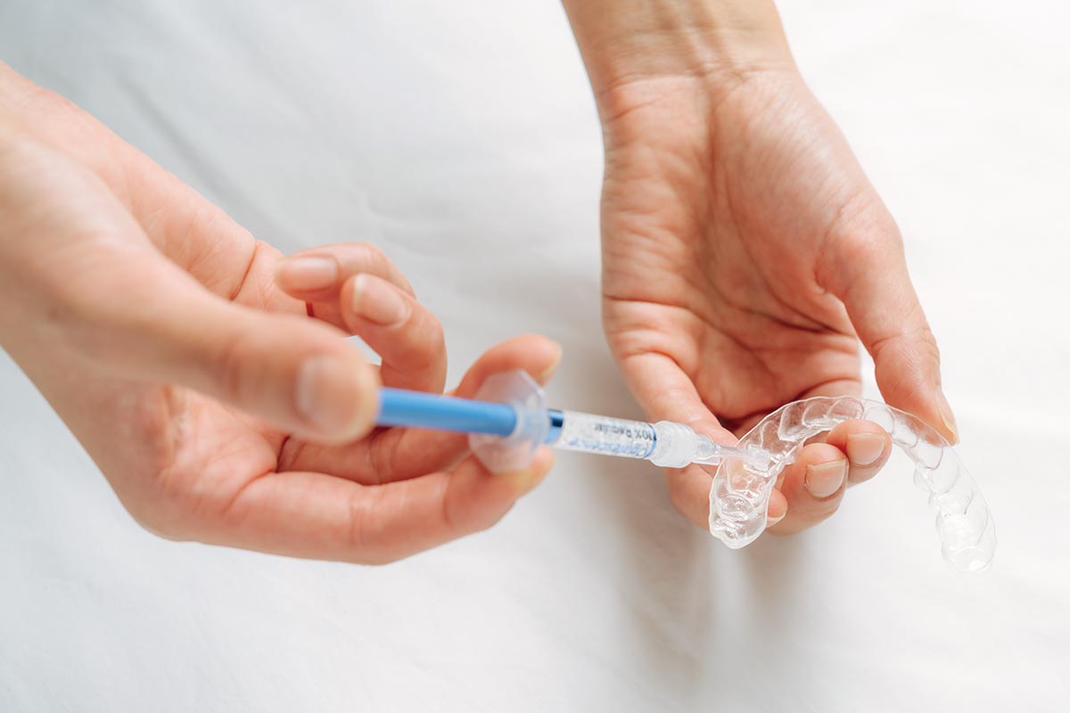 ホワイトニング演習